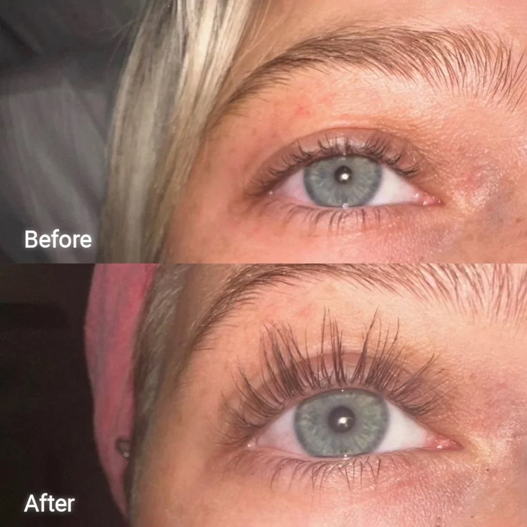 Eyelash Serum Twin Pack - Image 8