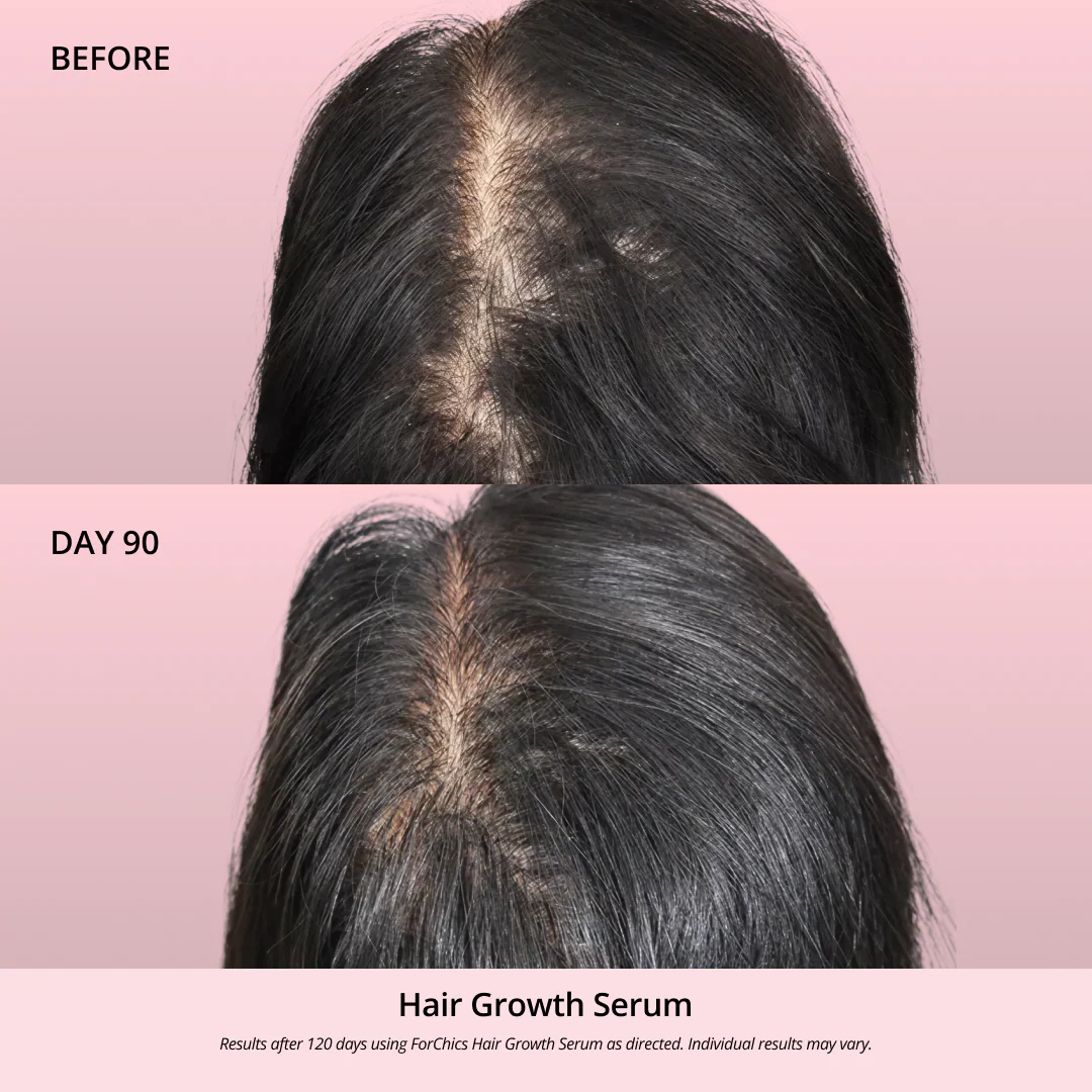 Hair Growth Oil Spray - Image 10