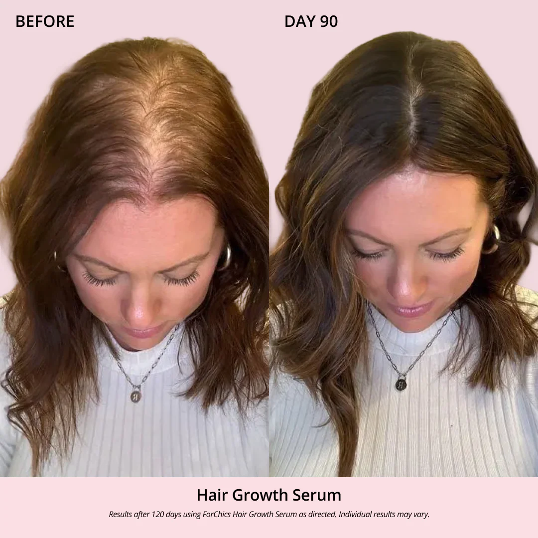 Hair Growth Oil Spray - Image 3