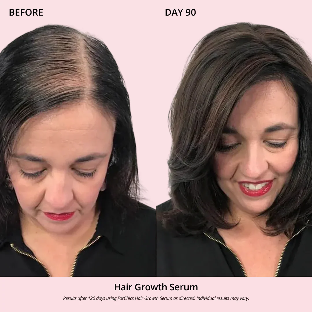 Hair Growth Oil Spray - Image 4