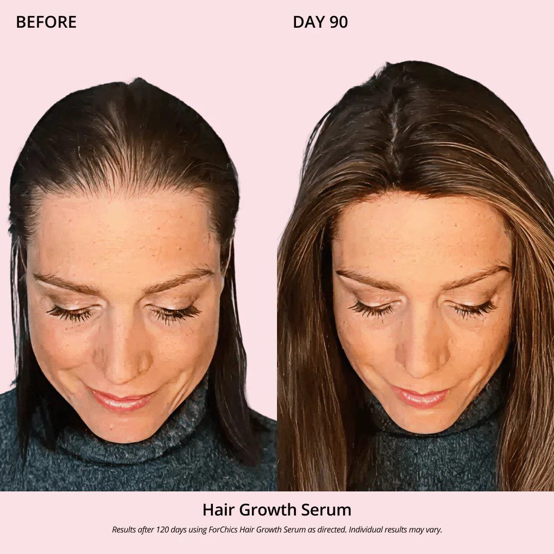 Hair Growth Oil Spray - Image 5