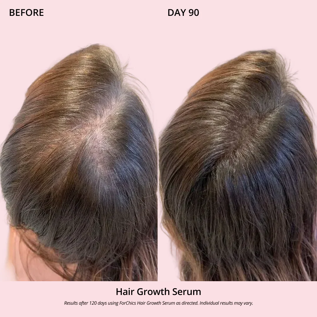 Hair Growth Oil Spray - Image 6