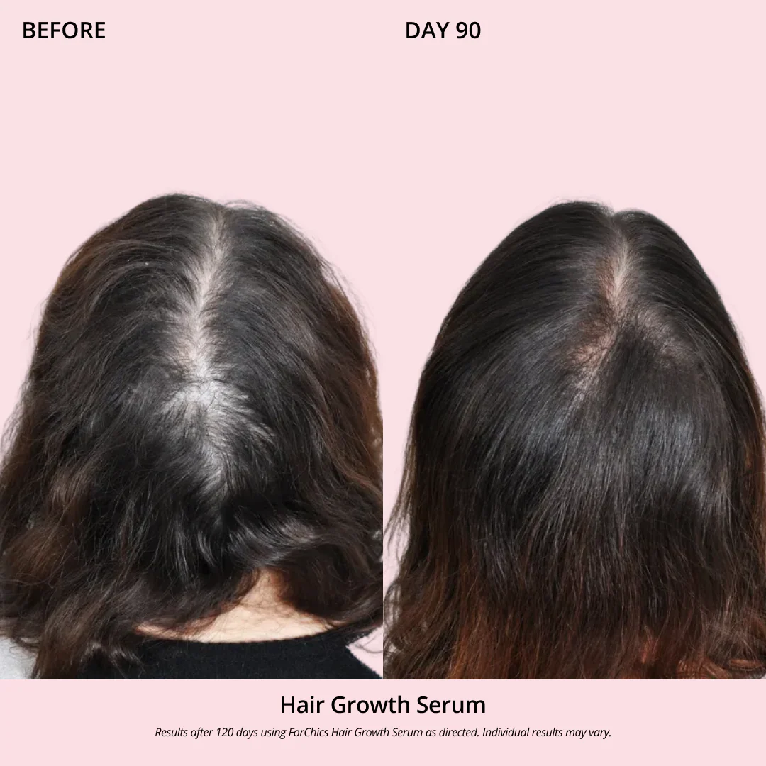 Hair Growth Oil Spray - Image 7