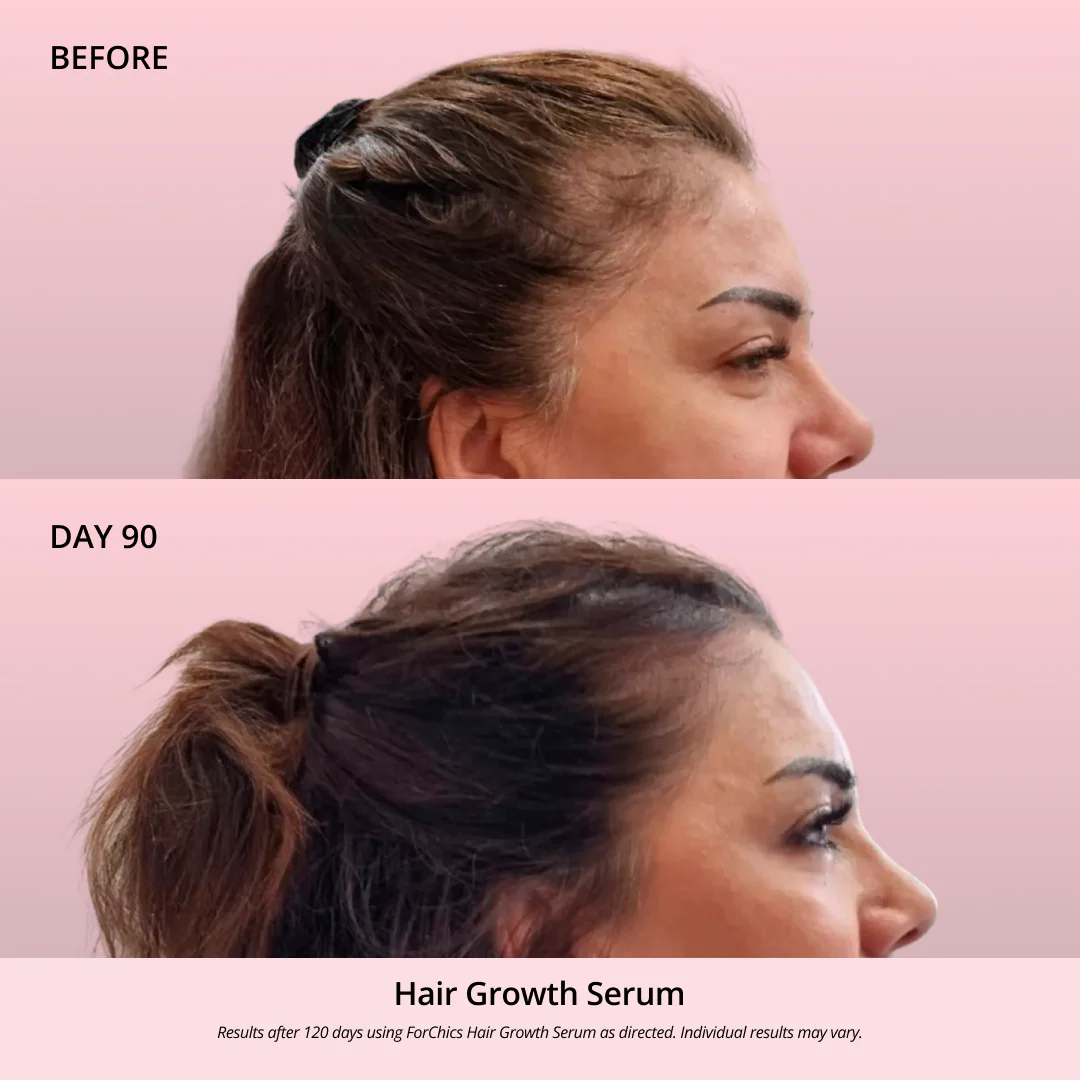 Hair Growth Oil Spray - Image 8