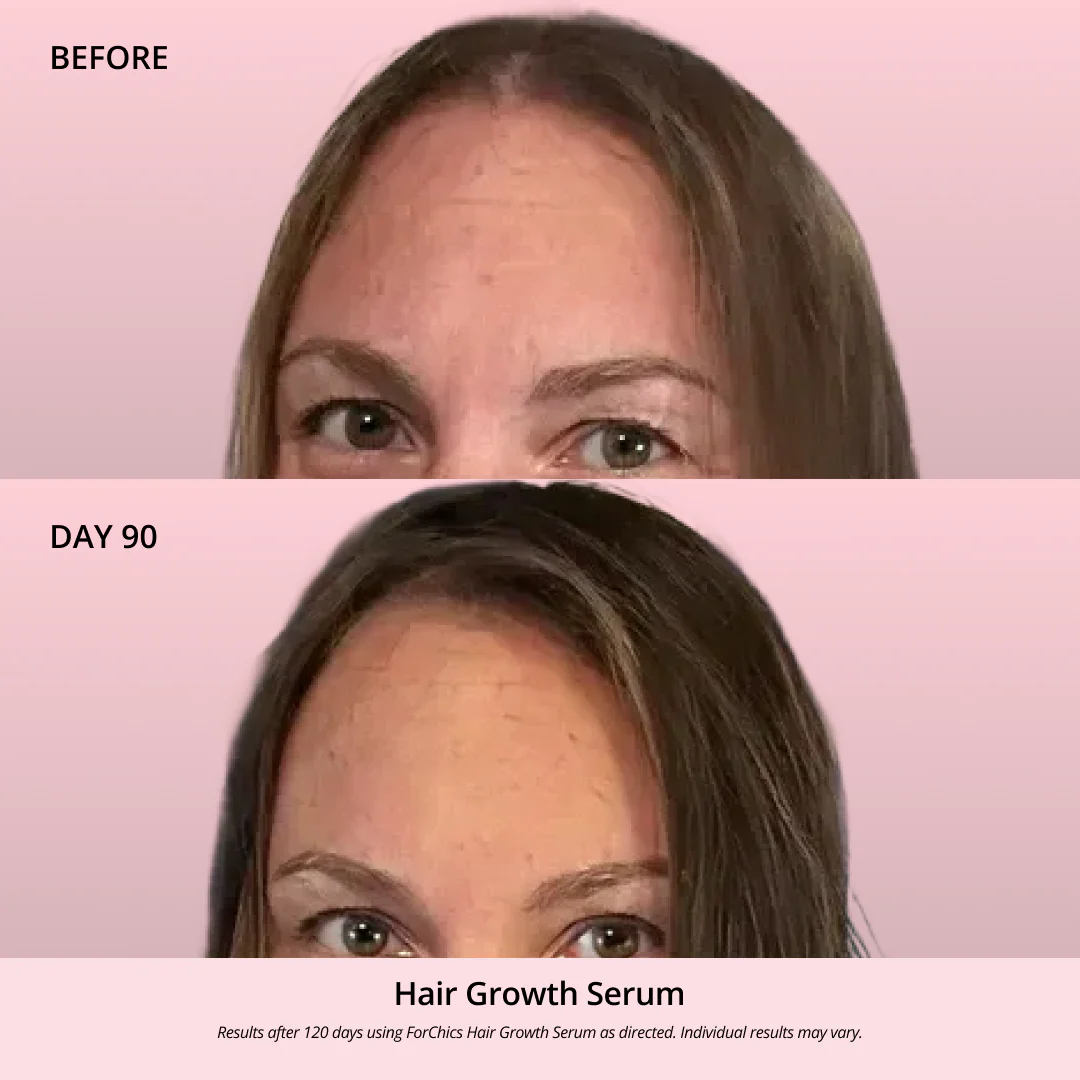 Hair Growth Oil Spray - Image 9