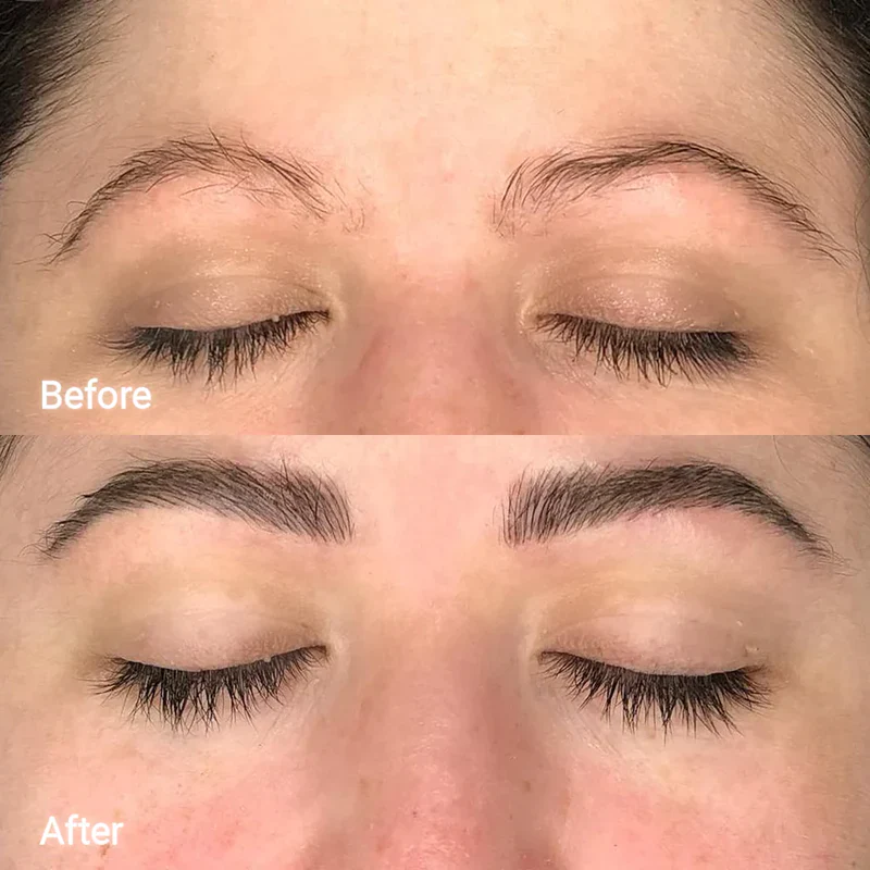 Lash and Brow Serum Set - Image 11
