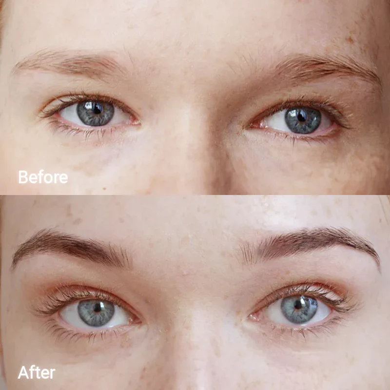 Lash and Brow Serum Set - Image 12