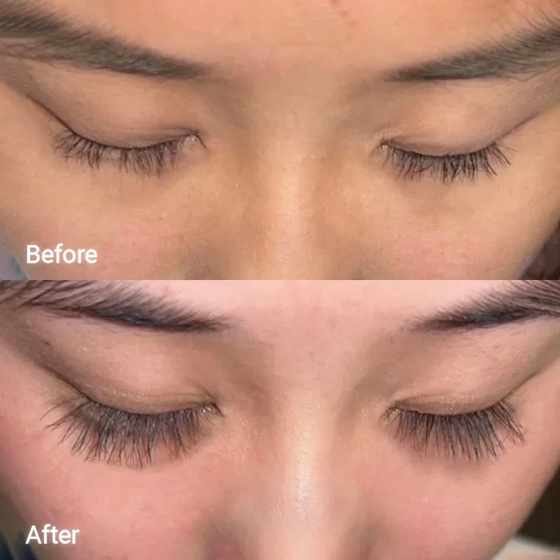 Lash and Brow Serum Set - Image 9